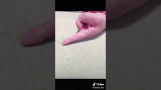 性病検査の採血なんて怖くないｗ